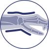 Immobilisation